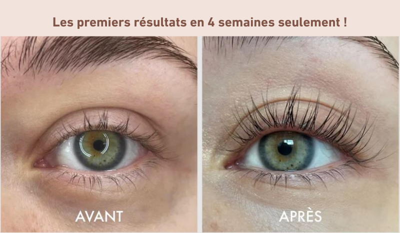 Sérum regard intense SORA®