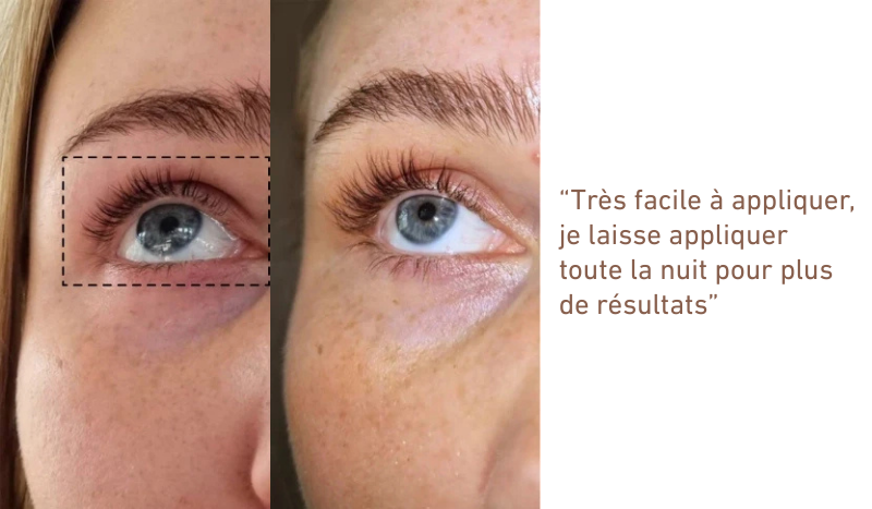 Sérum regard intense SORA®