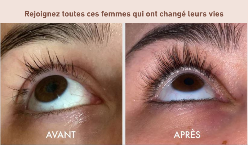 Sérum regard intense SORA®