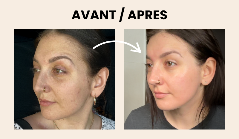 Crème anti-âge SEOUL 1988